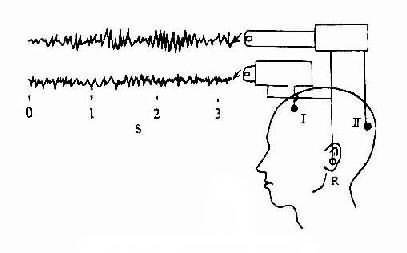 概述 脑电图(electroencephalogram, eeg)是通过电极记录下来的脑