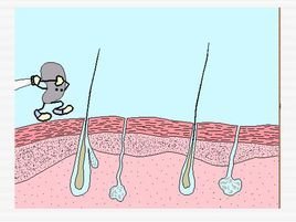 人体三道防线_360百科