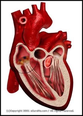 非感染性心内膜炎