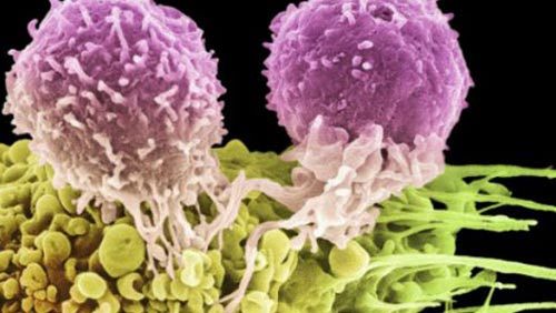 尖锐湿疣_360百科