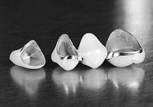 烤瓷牙有哪些种类?普通烤瓷牙是什么烤瓷牙?_360问答